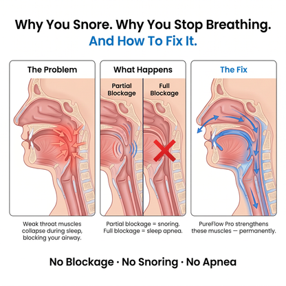 PureFlow Pro — NEMS Muscle Retraining for Snoring & Sleep Apnea