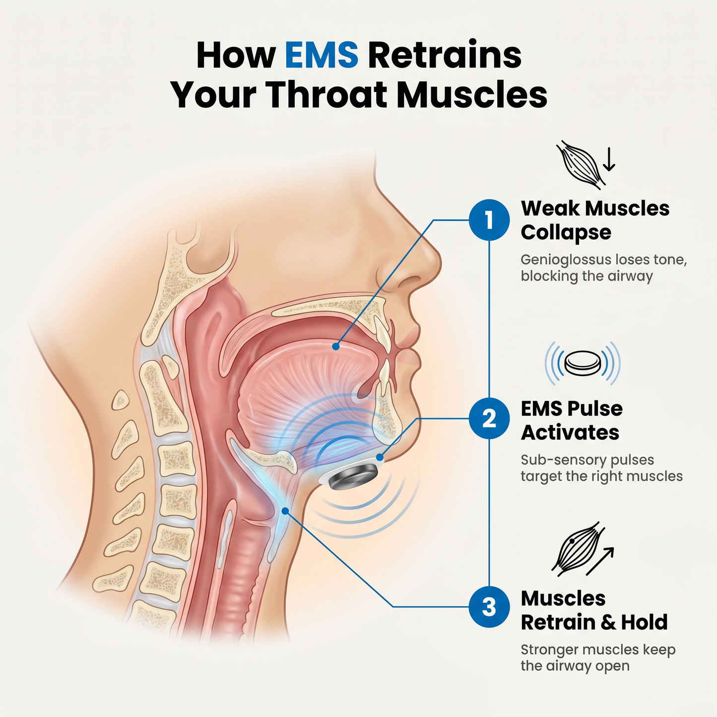 PureFlow Pro — NEMS Muscle Retraining for Snoring & Sleep Apnea