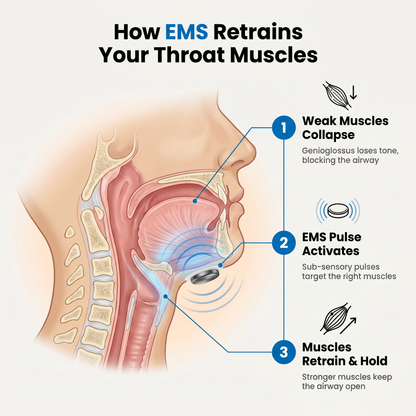 PureFlow Pro — NEMS Muscle Retraining for Snoring & Sleep Apnea